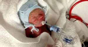 extreme_premature1_645_346_55